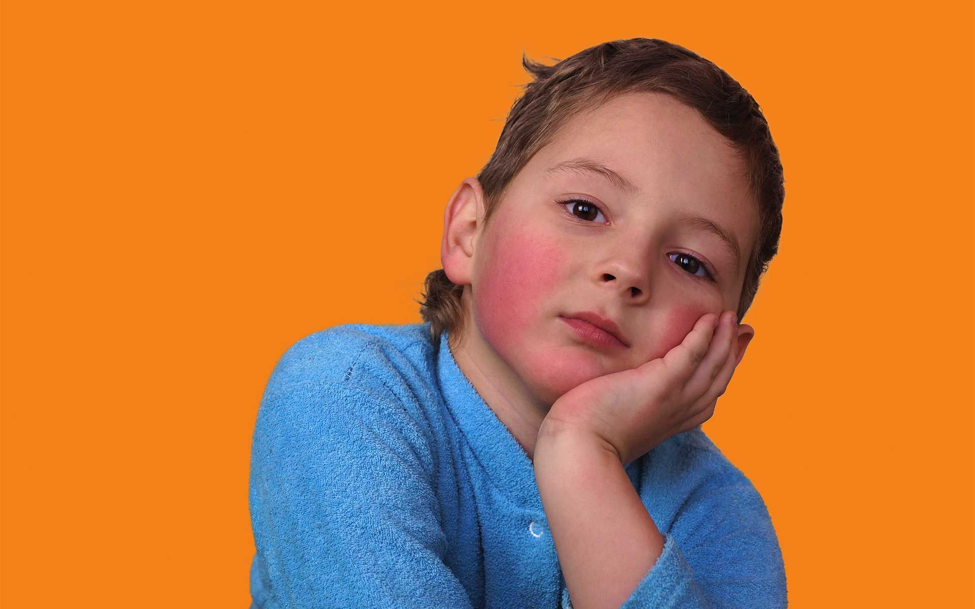 fifth-disease