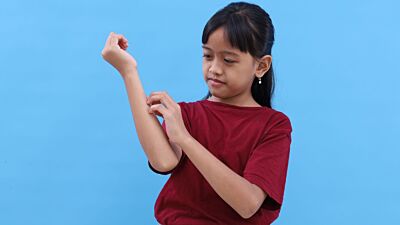 Overdrive: Psoriasis in Kids
