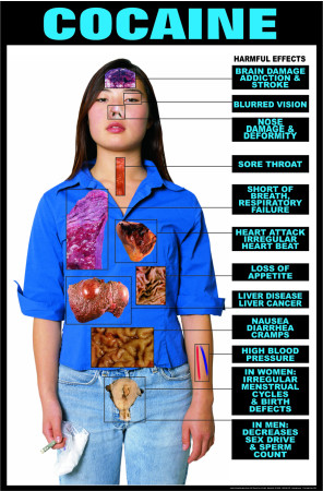 Harmful Effects of Cocaine, Laminated Poster