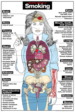 Harmful Effects of Smoking Chart, Laminated 24" x 36"