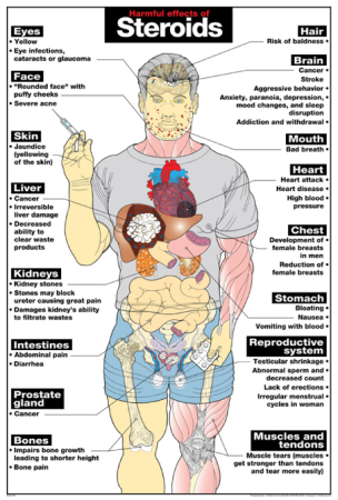 Harmful Effects of Steroids Laminated Poster