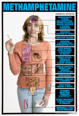 Harmful Effects of Methamphetamine, Laminated 24" x 36"