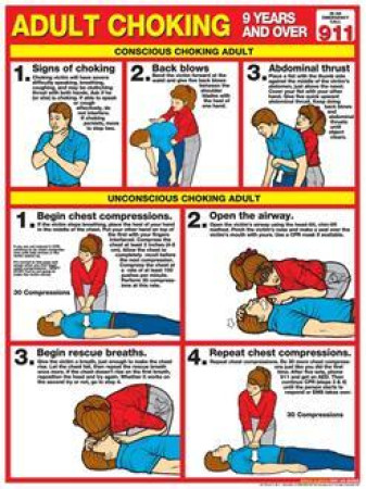 Adult Choking Chart, Laminated 18" x 24"