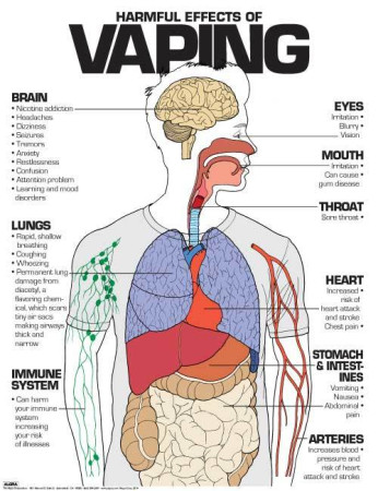 Harmful Effects of Vaping, 24" x 36" Laminated Poster