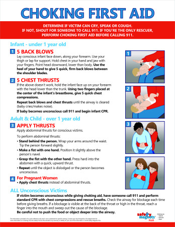 Choking First Aid Poster, 17" x 22", Laminated