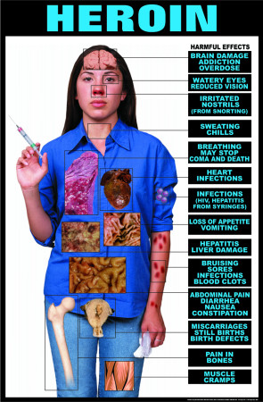 Harmful Effects of Heroin Laminated Poster