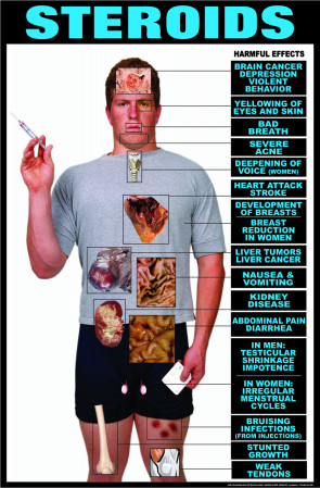 Harmful Effects of Steroids Laminated Poster
