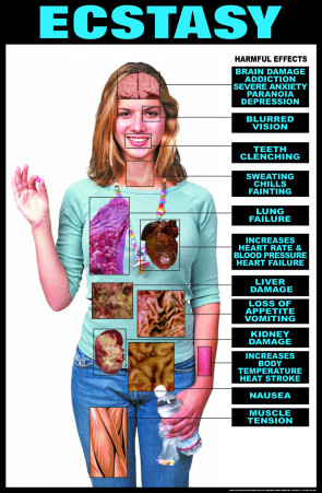 Harmful Effects of Ecstasy Laminated Poster