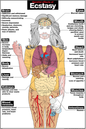 Harmful Effects of Ecstasy Laminated Poster