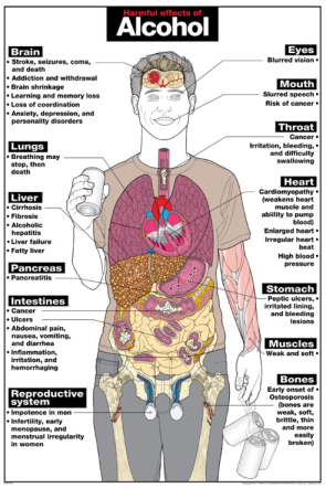 Harmful Effects of Alcohol Chart, Laminated 24" x 36"