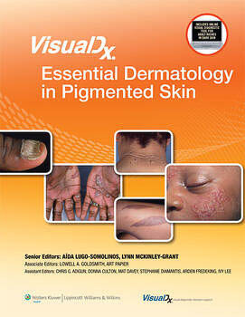 VisualDx: Essential Dermatology in Pigmented Skin