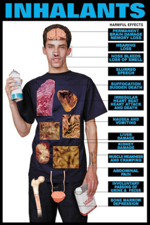 Harmful Effects of Inhalants Chart, Laminated 24" x 36"