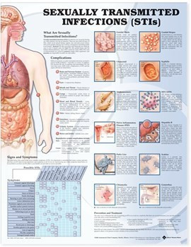 Sexually Transmitted Infections Chart, Laminated 20" x 26"