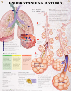 Understanding Asthma Chart, Laminated 20" x 26"