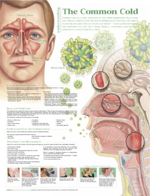 Understanding the Common Cold Chart, Laminated 20" x 26"