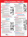 CPR & Choking First Aid Poster, 17" x 22", Laminated