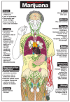 Harmful Effects of Marijuana Chart, Laminated 24" x 36"