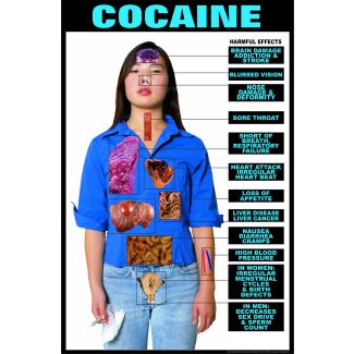 Harmful Effects of Cocaine, Laminated Poster