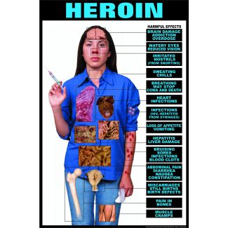 Harmful Effects of Heroin Laminated Poster