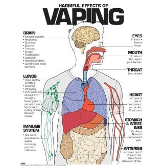 Harmful Effects of Vaping, 24" x 36" Laminated Poster