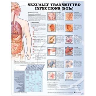 Sexually Transmitted Infections Chart, Laminated 20" x 26"