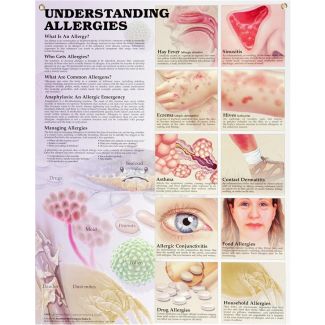 Understanding Allergies Chart, Laminated 20" x 26"