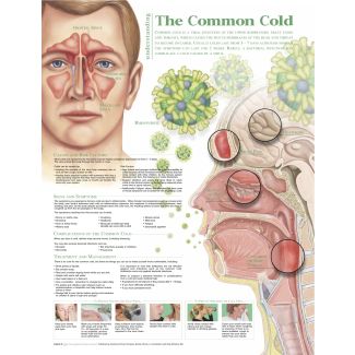 Understanding the Common Cold Chart, Laminated 20" x 26"